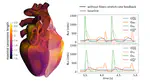 Cardiac modeling